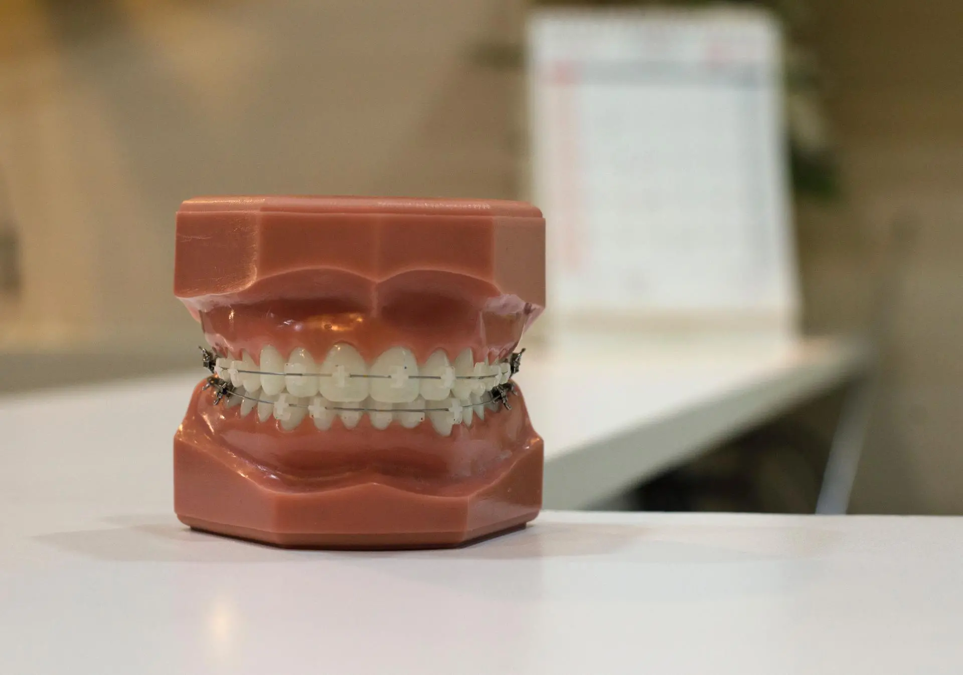 o mercado de implantes dentários
