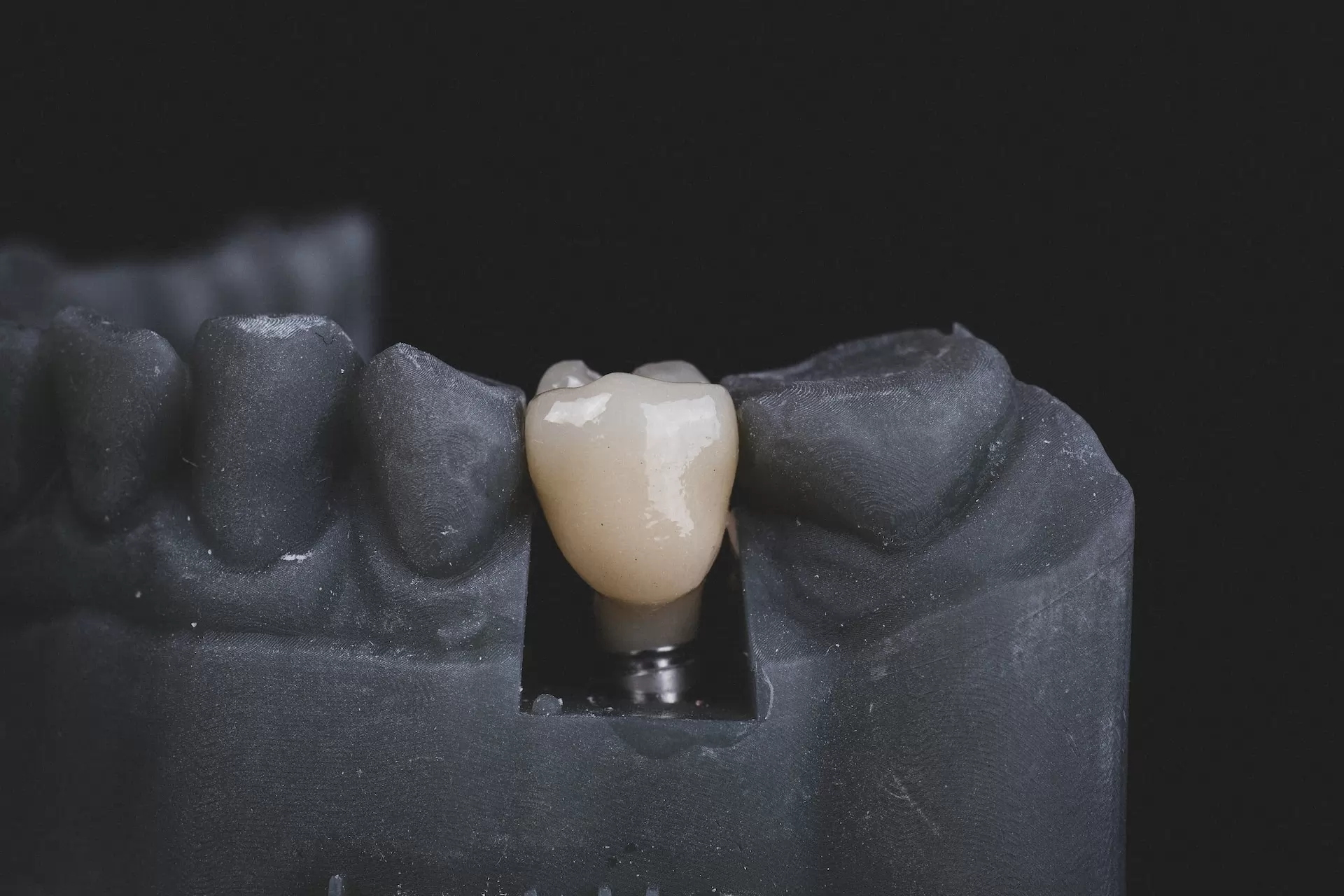 The market for dental implants