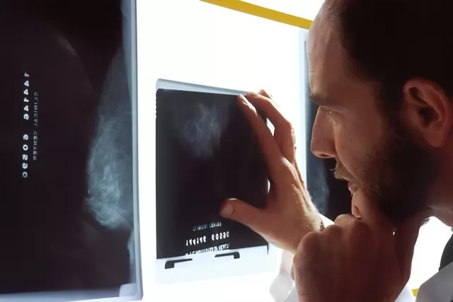 Le marché de la radiologie